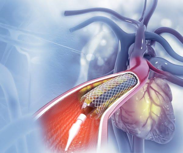 Diagnostic Catheterization in jordan 
